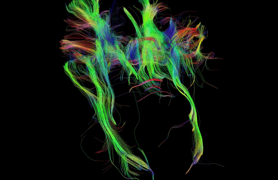 neurologie computationnelle